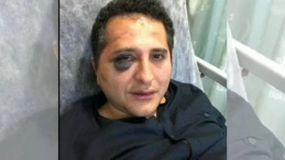 Erdoğan’ın avukat döven korumalarının dosyası, işkence ihtimaliyle Ağır Ceza’ya gönderildi